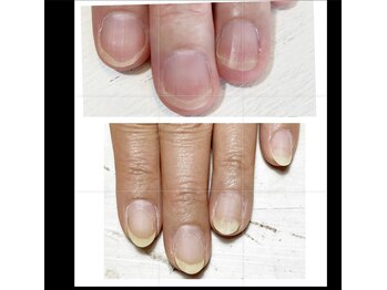 ミリアネイル 成城(Miliea nail)/地爪育成ネイルケア
