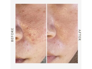 アンド(&.)/before/after