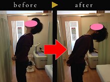 杉本接骨鍼灸院/若々しい背骨を取り戻す整体