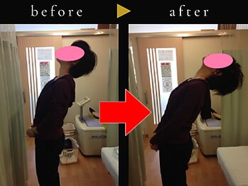 杉本接骨鍼灸院/若々しい背骨を取り戻す整体