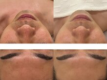 サンオーラ(SUN AURA)/男性人気◎トリートメント