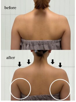 ベール(BEHL)/コルギのBefore After