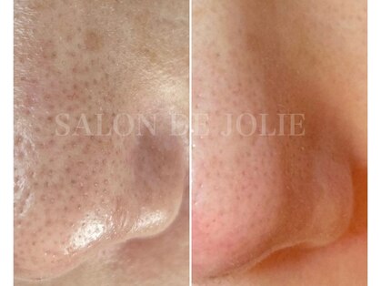 サロンドジョリーの写真