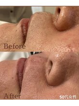 プアマヌ(PUA MANU)/フェイシャルwax光