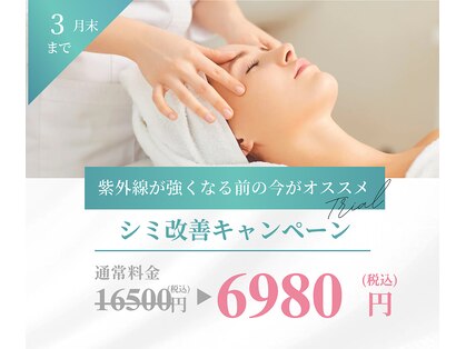 シャルナ(charna)の写真