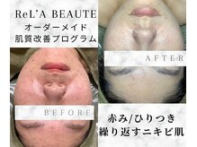 サザンベル 石垣店(SOUTHERN BELLE)/最高金賞受賞ハーブ☆リアボーテ