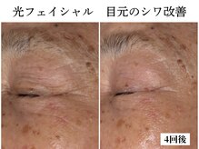アロマ(AROMA)の雰囲気(駐車場完備なので、気軽にご来店下さい。越谷/春日部/草加/大宮)