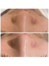 ル シェリア(Le Cherien)/Before &nbsp;After