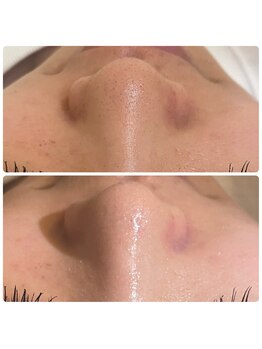 ル シェリア(Le Cherien)/Before After