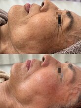 エレン(Elen)/筋肉にアプローチ！