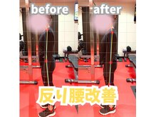 反り腰で悩まれている方も多いと思います◎骨盤改善でスッキリ!