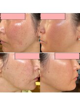 シシラ(shishira)/【Dr.Purで魅せる肌へ】