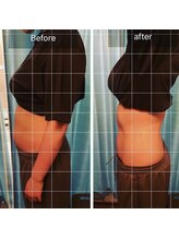 エルビタ(Elvita)/【通い放題プラン】70分／７回