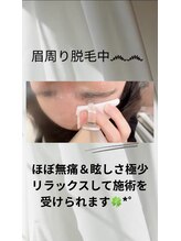 シュエット(Chouette)/眉周り脱毛 インスタ動画up中♪