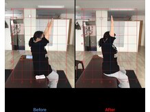 ストレチックス 近江八幡店/BeforeAfter