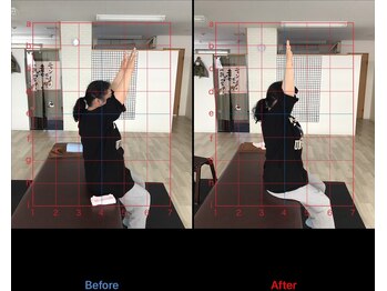 ストレチックス 近江八幡店/BeforeAfter