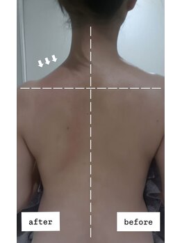 リブ シャルム(Lib Charm)/シークレシー首肩1回施術