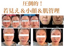 ティパニボーテ(Tipani Beaute')