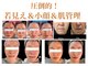 ティパニボーテ(Tipani Beaute')の写真
