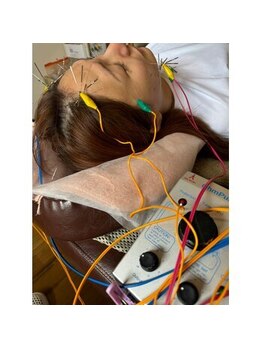 爽健美/電気を流す美容鍼