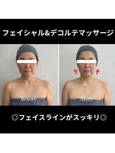 シュ シュ(chou chou)/フェイシャルデコルテマッサージ