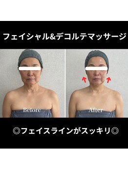 シュ シュ(chou chou)/フェイシャルデコルテマッサージ