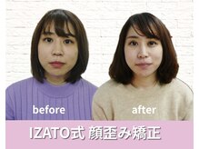 小顔矯正 イザト整体院(IZATO)/顔歪み矯正before＆after