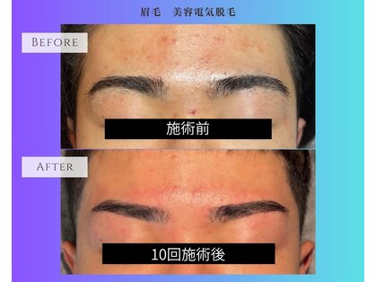 シーボウ(CBOU)の写真