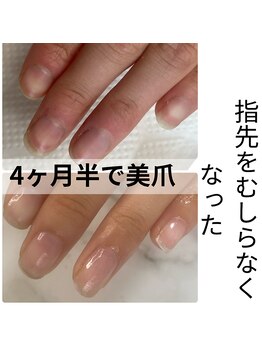 リフレシア(Rifrecia)/爪の悩み解消サロン　千葉県柏さ