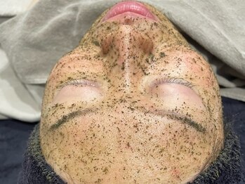 ニコリ(Nicori)/ハーブピーリング