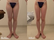 ラヴィエ ベル(La vie est belle)/下半身