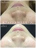 感謝を込めて2回目の方にも【光フェイシャル60分】濃厚浸透パック付★