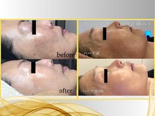 カド 白金台(Kado)/リジュラン◆美白・抗シワハーブ