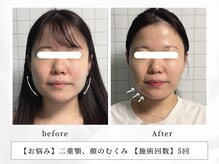 レッド(RED)/フェイスラインを出すならRED