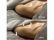 ベール(BEHL)/コルギのBefore After