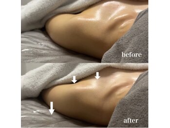 ベール(BEHL)/コルギのBefore After