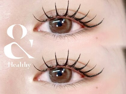 モルン(moln)の写真