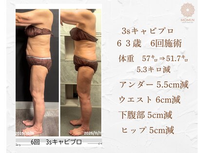 モミン(MOMI.N)の写真