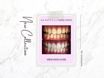 ホワイト つくば店(WHITE)/圧倒的な効果(5回照射)