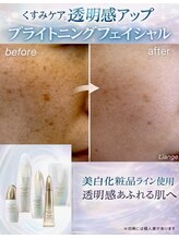 リアンジュ(Liange)/40代くすみ美白ビフォーアフター