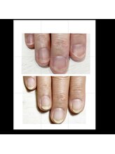 ミリアネイル 成城(Miliea nail)/地爪育成ネイルケア