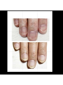 ミリアネイル 成城(Miliea nail)/地爪育成ネイルケア