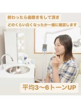 ホワイトニングビューティー 西宮店/お疲れ様です♪歯の色チェック