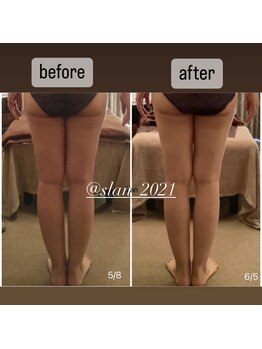 スラン(Slan)/美骨痩身×筋膜リリース60分