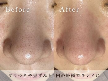 ハリウッド ラボ 本店(HOLLYWOOD LAB)/