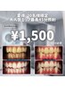 【夏得★20名限定】エリア最長ホワイトニング45分照射【¥1,500】クチコミ必須