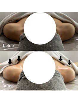 ベール(BEHL)/コルギのBefore After