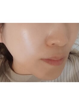 美白ケアをしたい