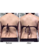 バイブスプラス(Vibes+)/