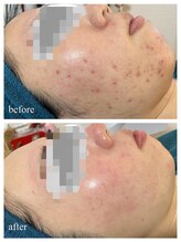 リノルーア(Linolua)/